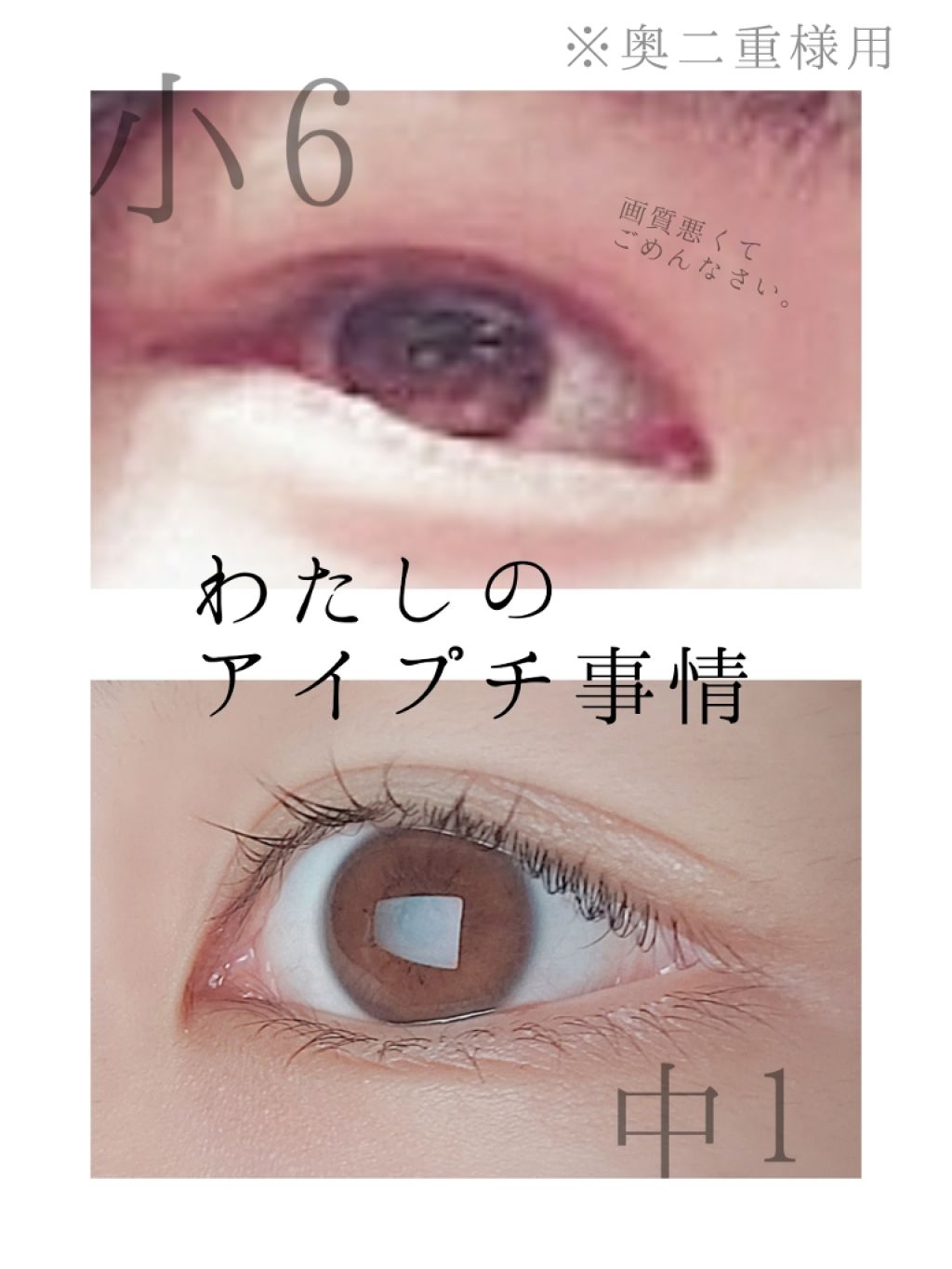 【旧品】オリシキ アイリッドスキンフィルム/D-UP/二重まぶた用アイテムを使ったクチコミ（1枚目）