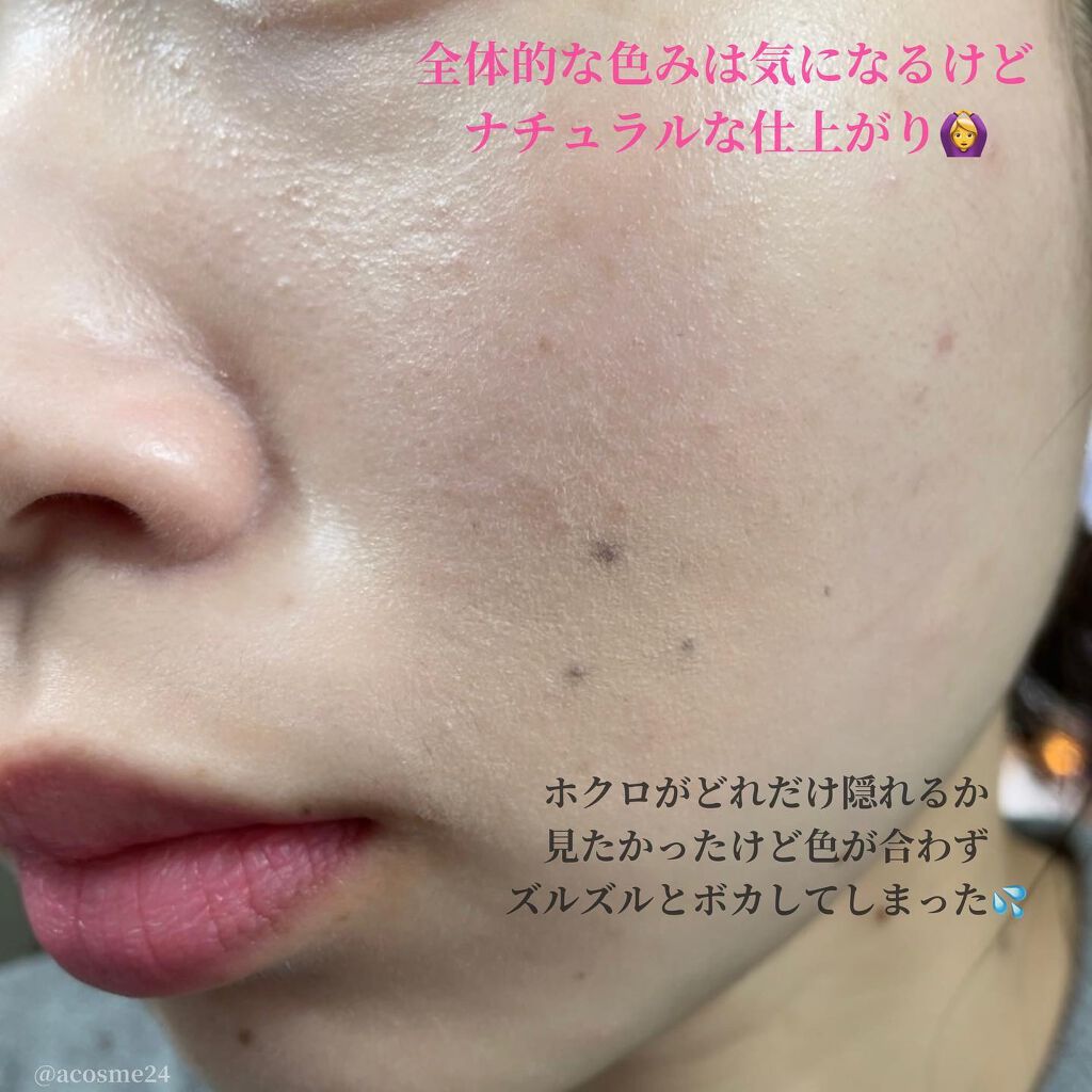 【旧】ディオールスキン フォーエヴァー スキン コレクト コンシーラー/Dior/リキッドコンシーラーを使ったクチコミ(7枚目)