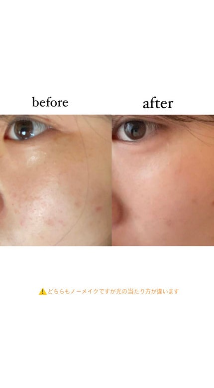 PLUMINUS/mous./美顔器・マッサージを使ったクチコミ(1枚目)