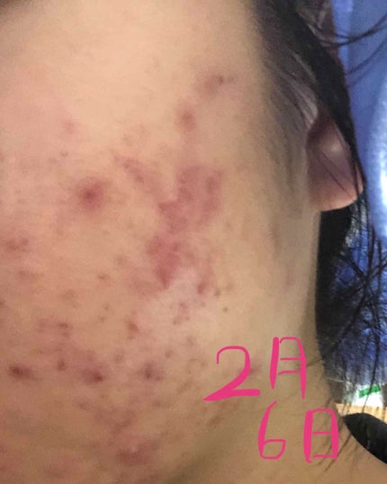 を使ったクチコミ(1枚目)