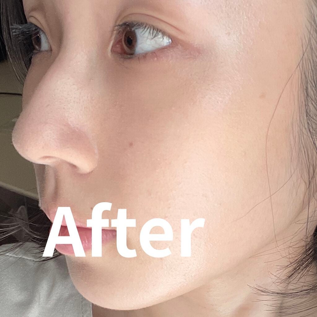 【旧】ディオールスキン フォーエヴァー スキン コレクト コンシーラー/Dior/リキッドコンシーラーを使ったクチコミ(4枚目)