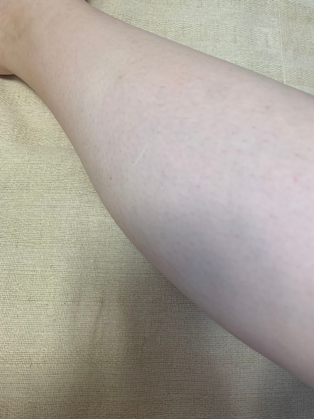 無名のひよこ on LIPS 「こんにちは、無名のひよこです(•ө•)前回から案件・PRなし辛..」(3枚目)