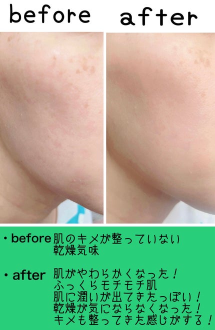 ハニーマスク/I'm from/洗い流すパック・マスクを使ったクチコミ(7枚目)