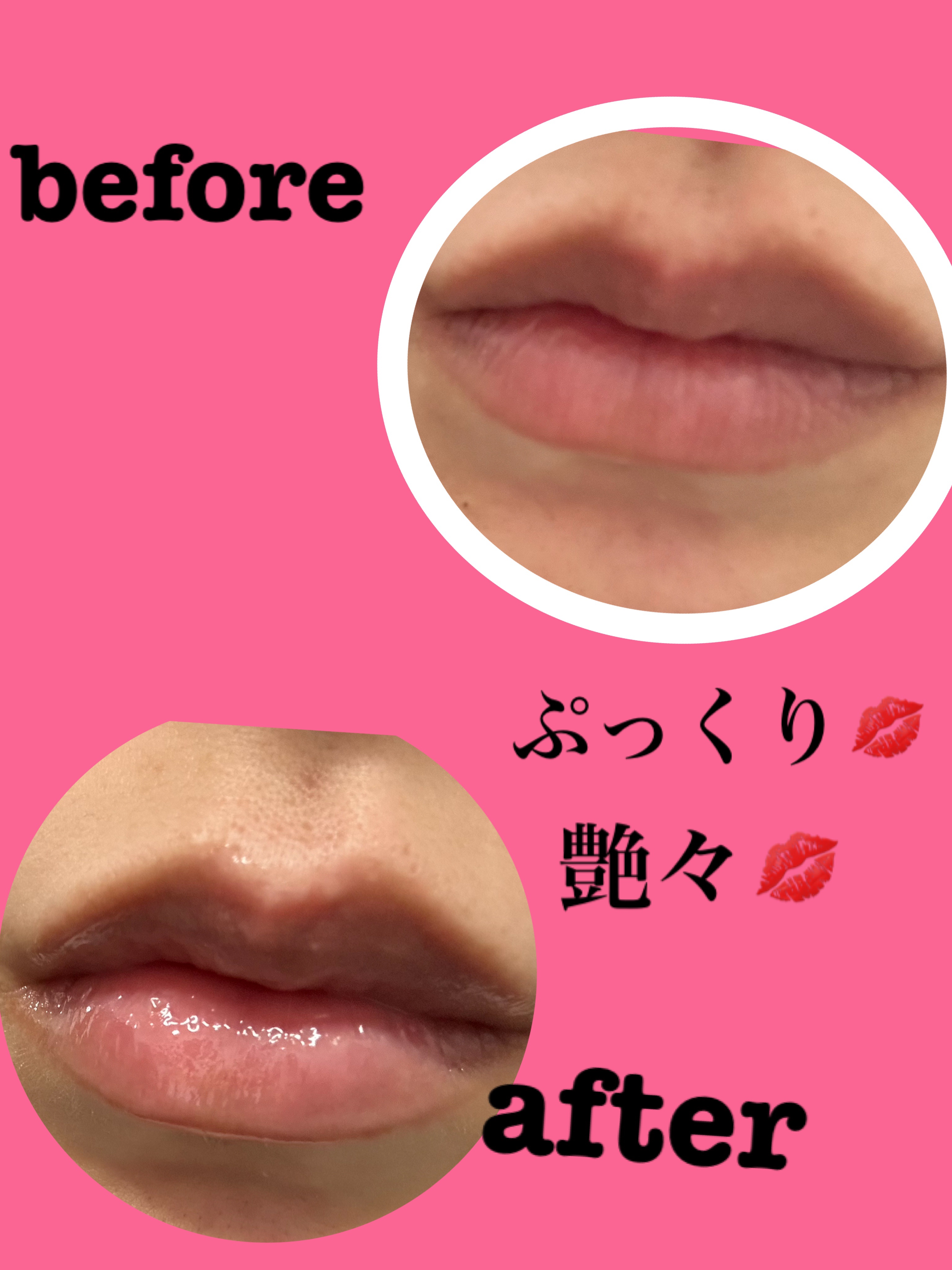 イリュン コラーゲンモイスチャーリップマスク/illuN/リップマスクを使ったクチコミ（2枚目）