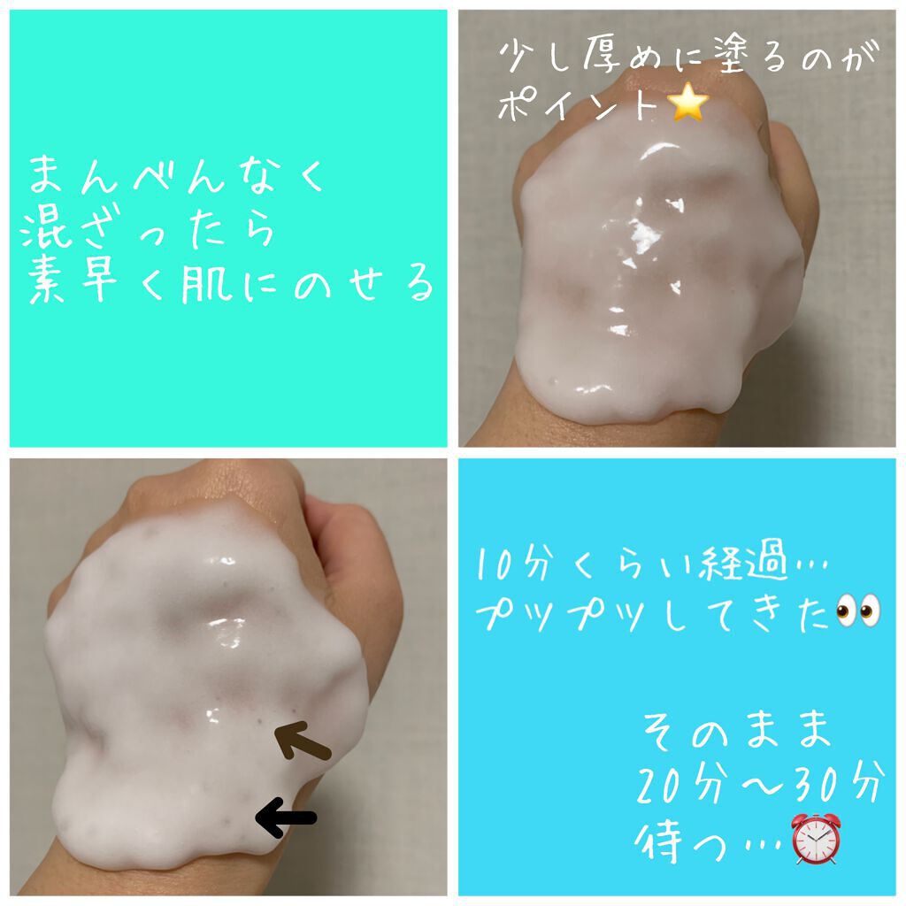 炭酸パック プルリ/ウツクシア/洗い流すパック・マスクを使ったクチコミ(4枚目)