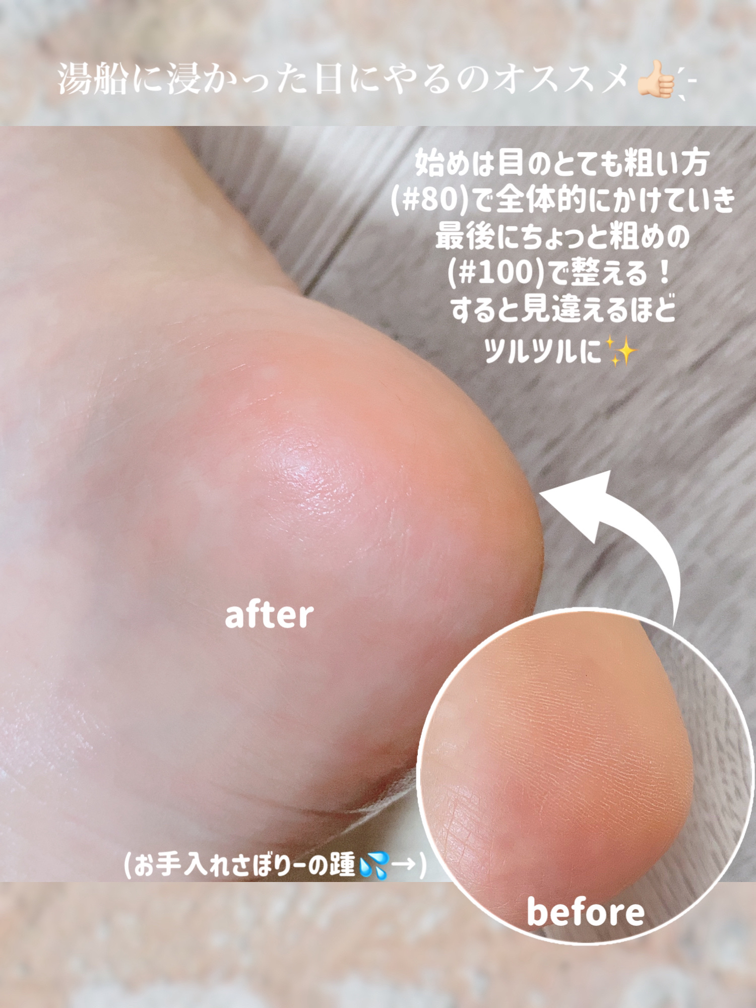 フットファイル/PERFECT NAILS/レッグ・フットケアを使ったクチコミ（2枚目）