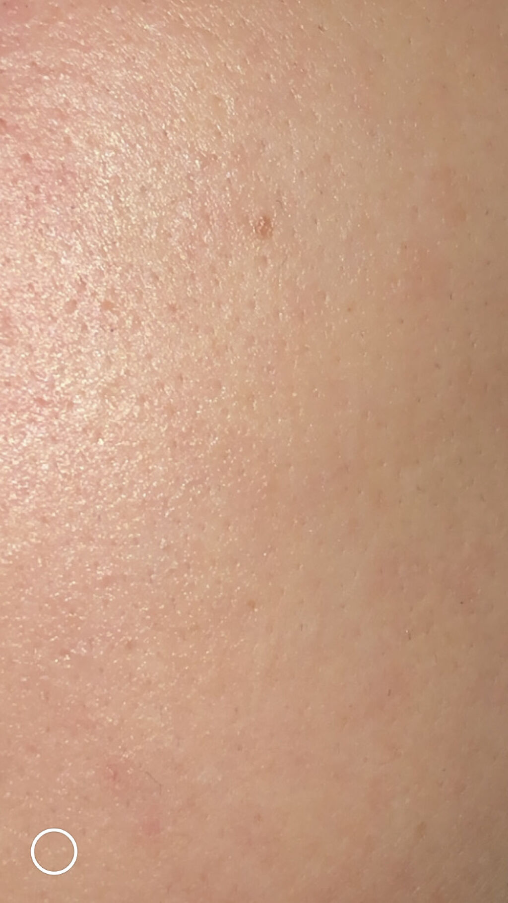 デュアック配合ゲル/ポーラファルマ/その他を使ったクチコミ（2枚目）