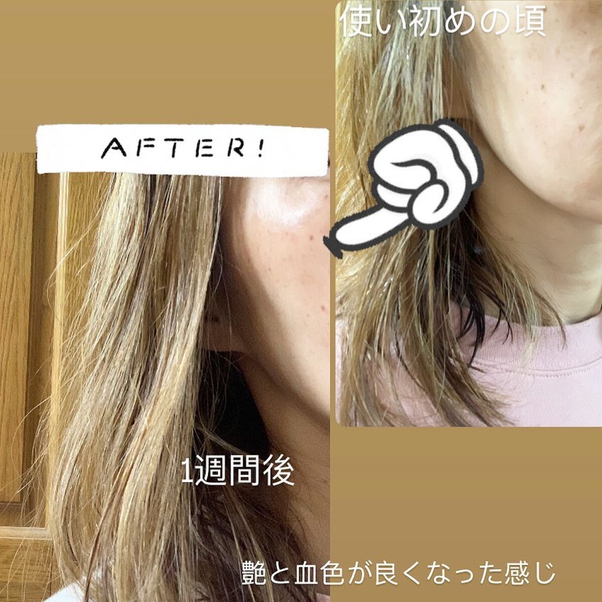 リードルショット300/VT/美容液を使ったクチコミ(5枚目)