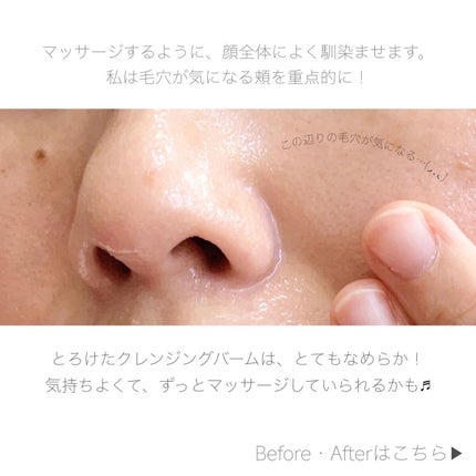 ダヴ すっきり毛穴ケアクレンジングバーム/ダヴ/クレンジングバームを使ったクチコミ(6枚目)