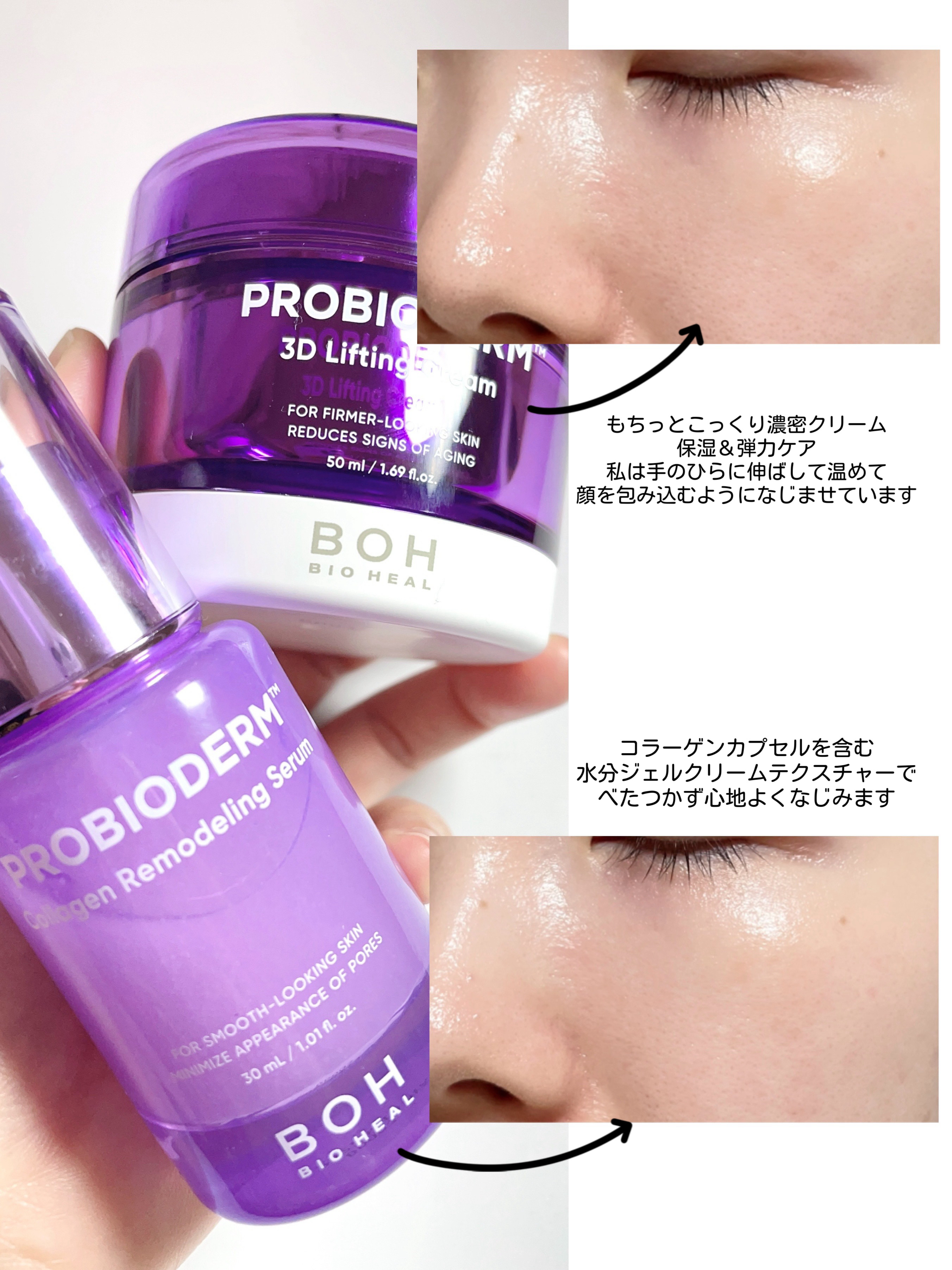 バイオヒールボ プロバイオダーム 3Dリフティングクリーム/BIOHEAL BOH/フェイスクリームを使ったクチコミ（2枚目）