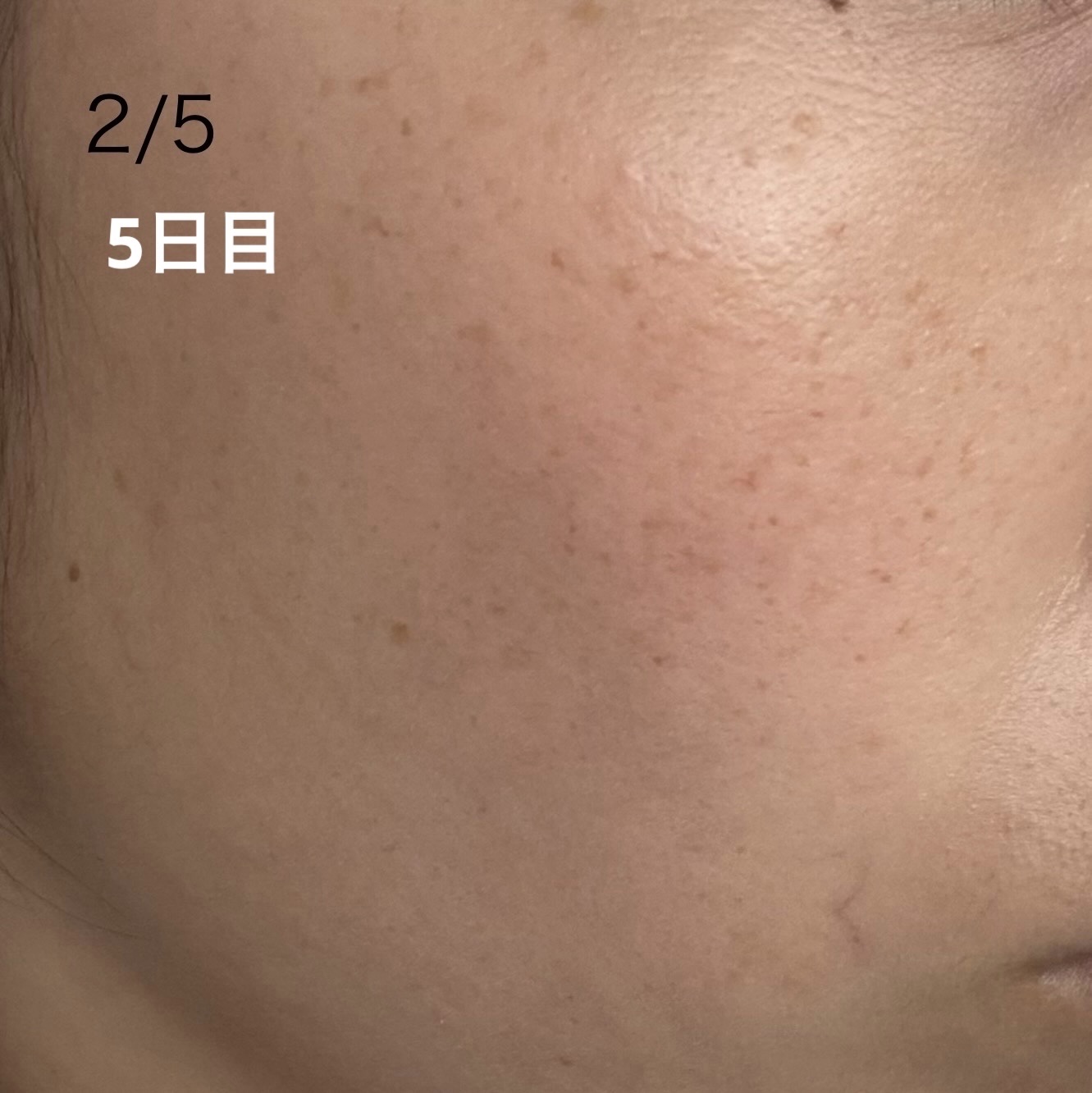 メラノフォーカスＥＶ 本体（45g）/HAKU/美容液を使ったクチコミ（2枚目）