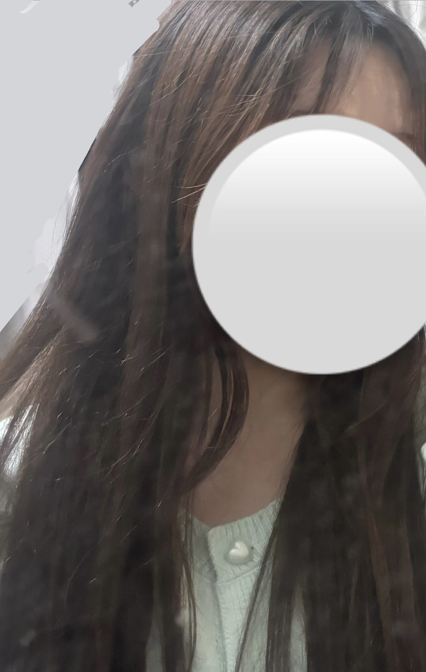 クリアエッセンスマスク/ピュレア/シートマスク・パックを使ったクチコミ（1枚目）