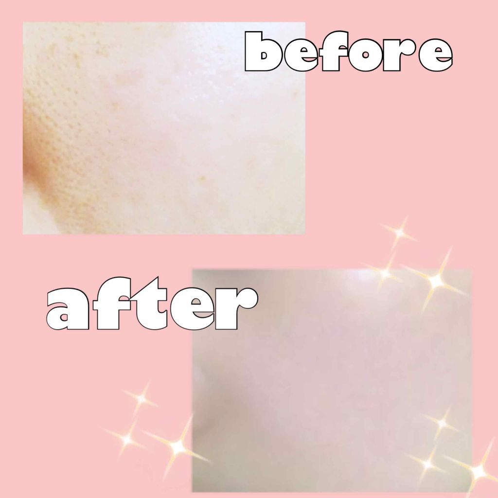 タン アンクル ド ポー/YVES SAINT LAURENT BEAUTE/リキッドファンデーションを使ったクチコミ(3枚目)