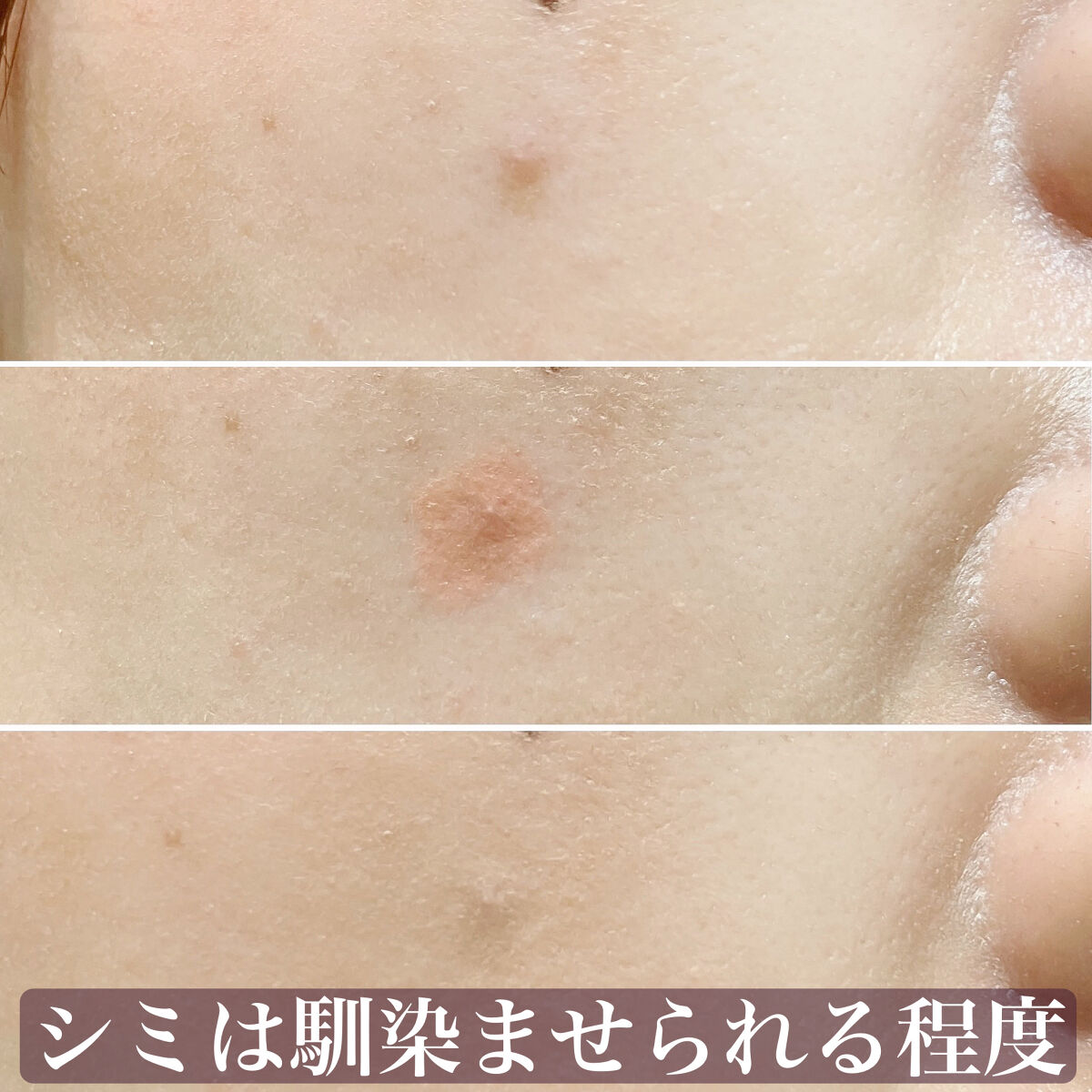 リシェ レッドトリック アイコンシーラー/Visée/パレットコンシーラーを使ったクチコミ（3枚目）