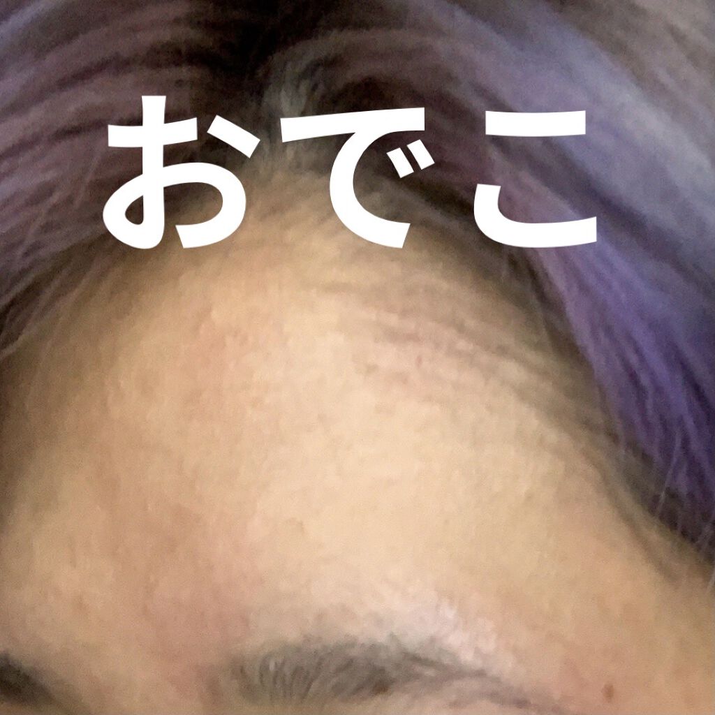 ハトムギ化粧水(ナチュリエ スキンコンディショナー R )/ナチュリエ/化粧水を使ったクチコミ（2枚目）