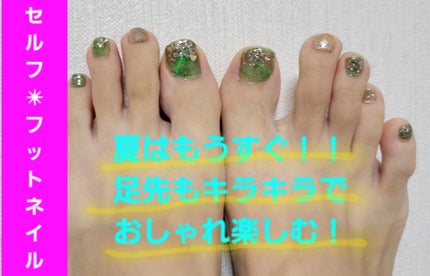 デコレーションネイルパーツ/DAISO/ネイルチップ・パーツを使ったクチコミ(1枚目)