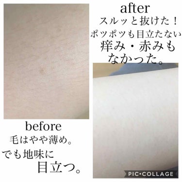 バスタイム除毛クリーム 敏感肌用/Veet/除毛クリームを使ったクチコミ（2枚目）