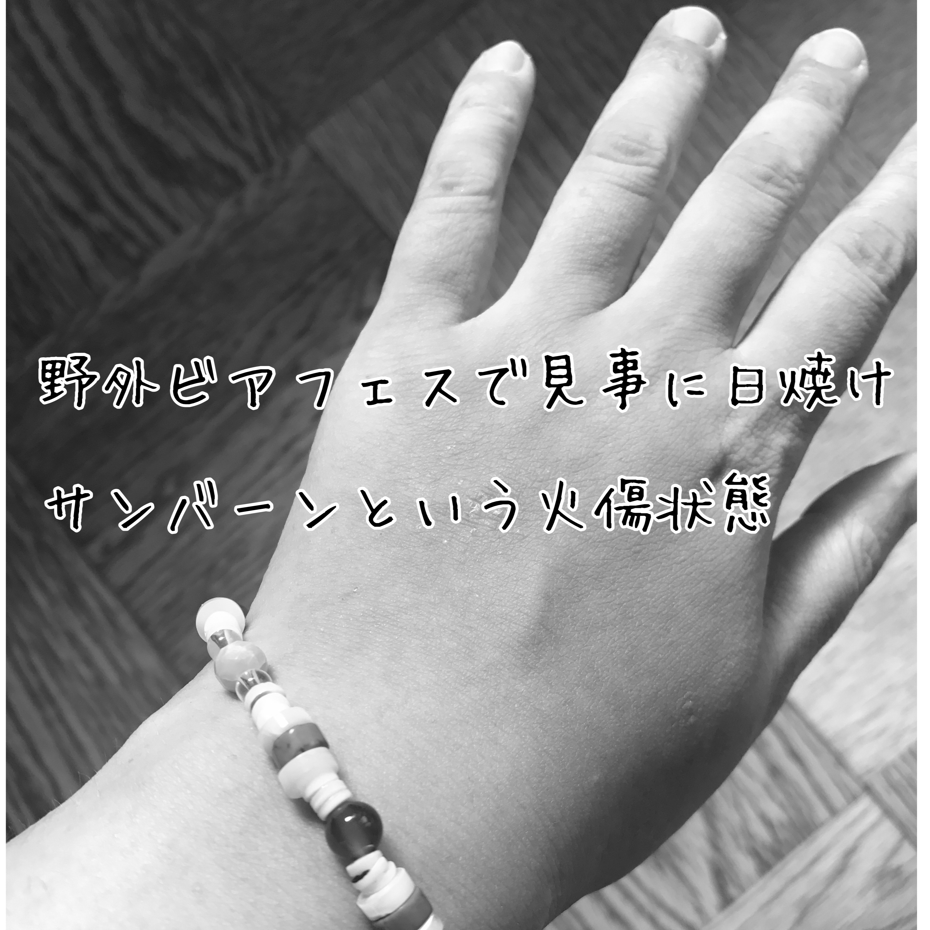 ミノン アミノモイスト モイストチャージ ローションII もっとしっとりタイプ/ミノン/化粧水を使ったクチコミ（2枚目）