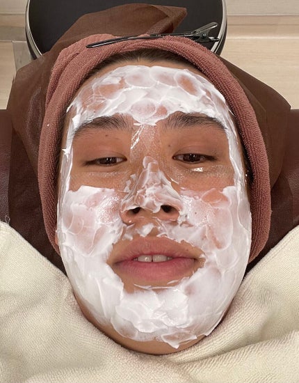 ダーマペン・ダーマスタンプ/MyM/その他スキンケアグッズを使ったクチコミ(1枚目)