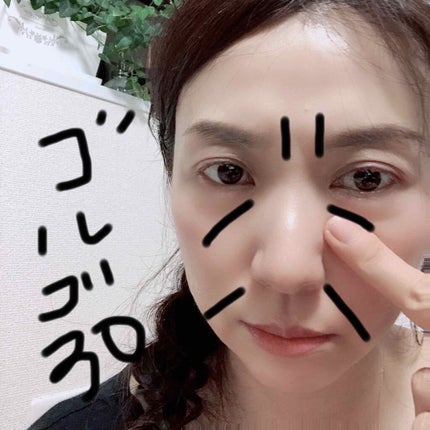 大人のゴルゴ線ショット/ハリーハリー/美容液を使ったクチコミ(1枚目)