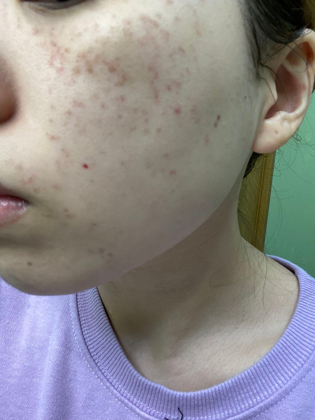 ポアナクレンジングオイル/DHC/オイルクレンジングを使ったクチコミ(4枚目)