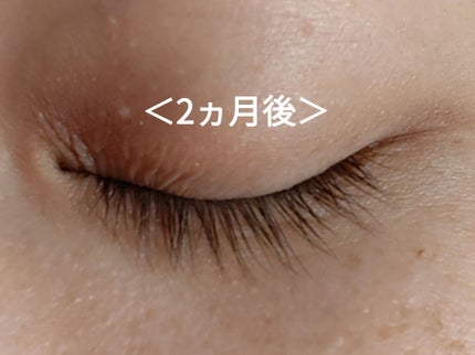 まつ毛美容液DA/DAISO/まつげ美容液を使ったクチコミ(5枚目)
