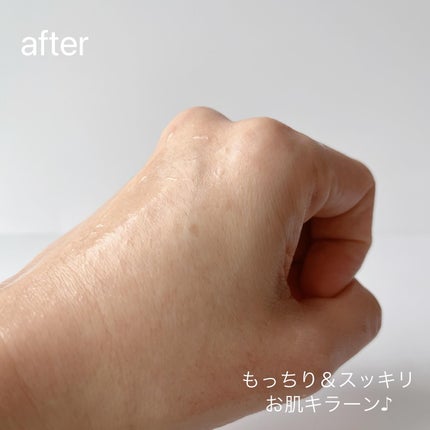 フィグスクラブマスク/I'm from/スクラブ・ゴマージュを使ったクチコミ(6枚目)