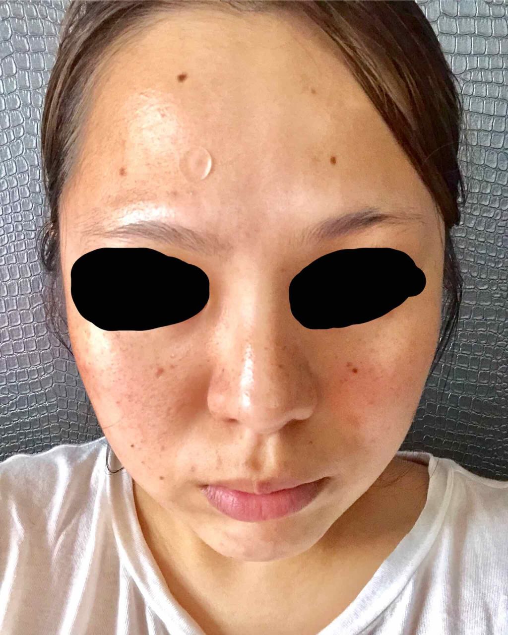 アクティブデイリービタミン/オルビス/美容サプリメントを使ったクチコミ(3枚目)