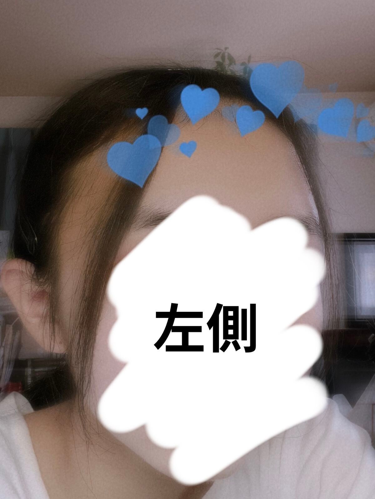 ヘアアクセルレーターEX フローラルアップルの香り/加美乃素本舗/頭皮ローションを使ったクチコミ(2枚目)