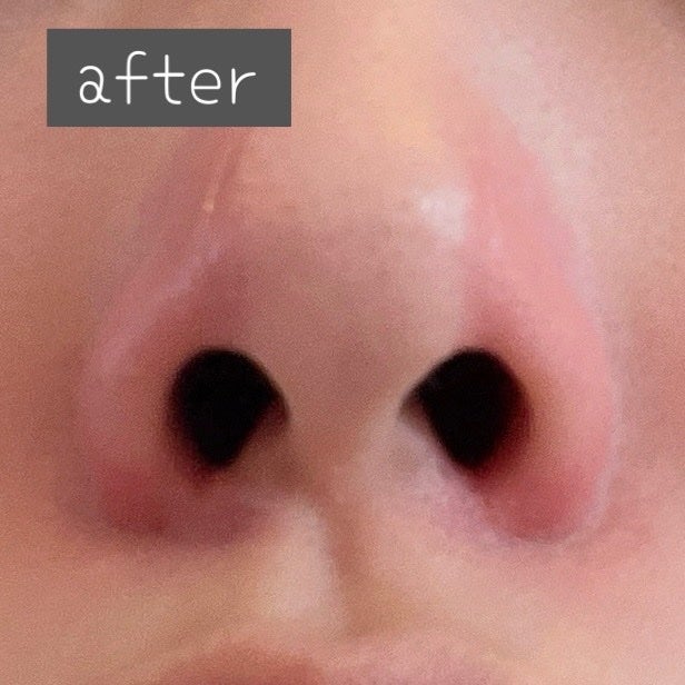 Fornez(フォーネス)/LUXCEAR/美顔器・マッサージを使ったクチコミ(6枚目)