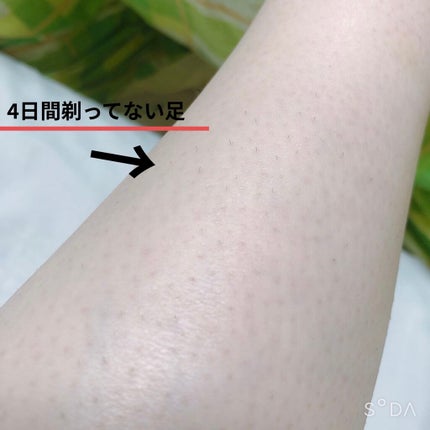 光脱毛器 VIO/Sarlisi/家庭用脱毛器を使ったクチコミ(3枚目)