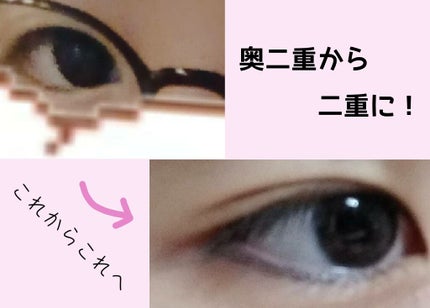 アイトーク/アイトーク/二重まぶた用アイテムを使ったクチコミ(1枚目)
