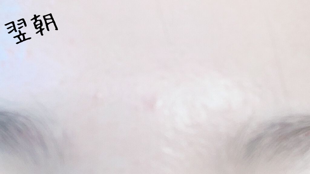 ティーツリーケア ソリューション エッセンシャルマスクEX/MEDIHEAL/シートマスク・パックを使ったクチコミ（2枚目）