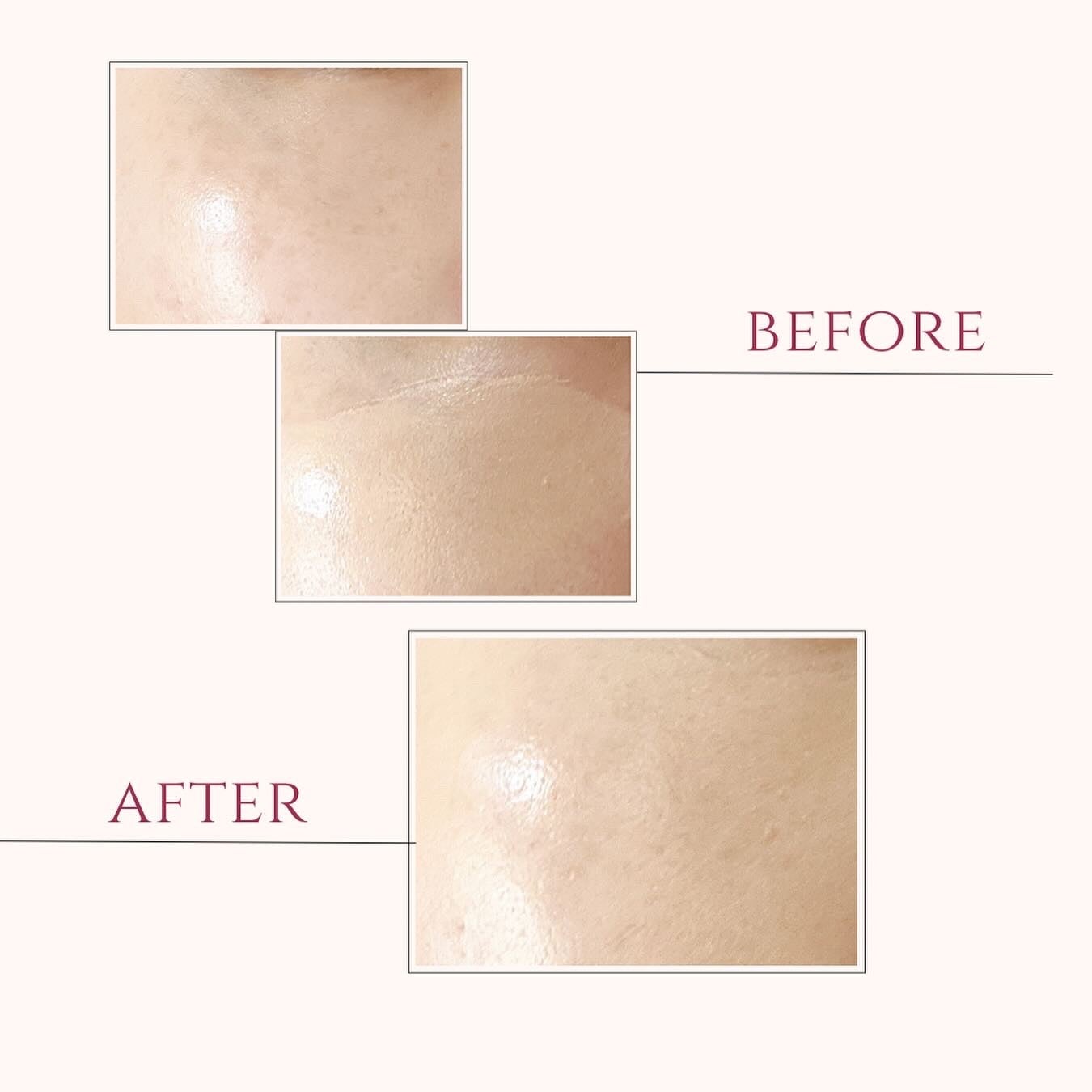 パーフェクトカバーオーロラバームクッション/Chic Blanco/その他ファンデーションを使ったクチコミ(3枚目)