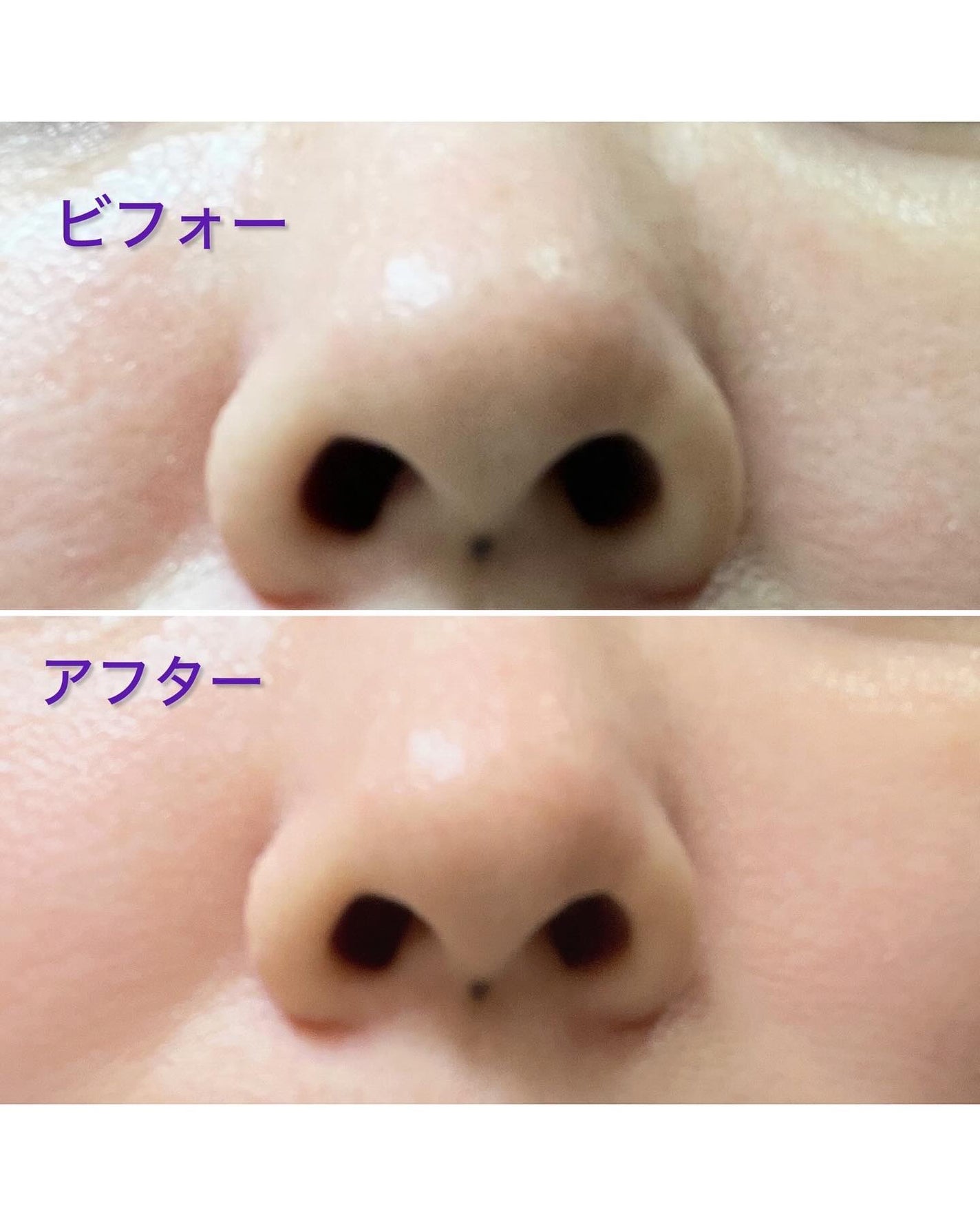 ナチュラルマイルドクリアノーズパック/ilso/シートマスク・パックを使ったクチコミ(6枚目)