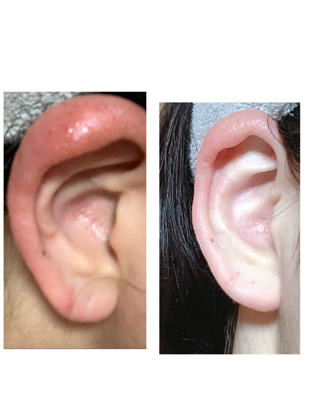 ミーミエイド(医薬品)/小林製薬/その他を使ったクチコミ(2枚目)