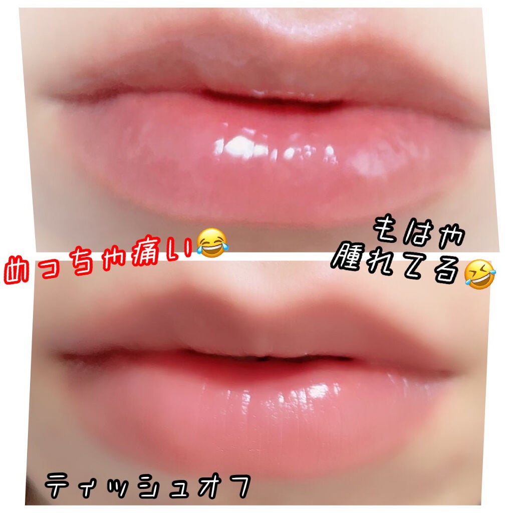 ドトムリッププラスプランパー/keybo/リッププランパーを使ったクチコミ(3枚目)