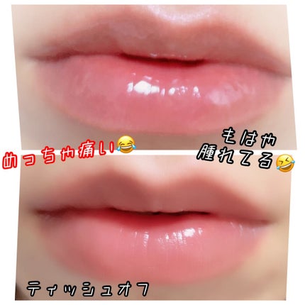 ドトムリッププラスプランパー/keybo/リッププランパーを使ったクチコミ(3枚目)