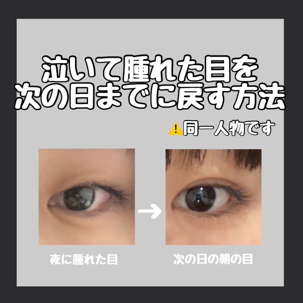 二重になる方法 のび る アイテープ 絆創膏タイプ Daisoの使い方や二重メイク 泣いた目を次の日までに By らむ コメントでフォロバ 乾燥肌 代前半 Lips