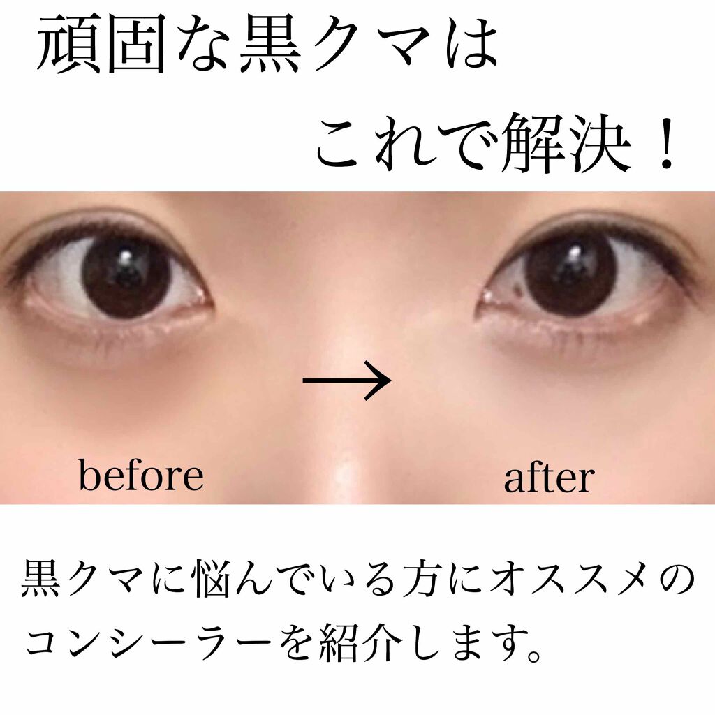 ラディアント タッチ/YVES SAINT LAURENT BEAUTE/リキッドコンシーラーを使ったクチコミ(1枚目)