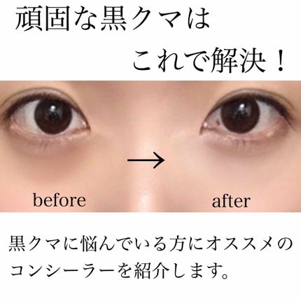 ラディアント タッチ/YVES SAINT LAURENT BEAUTE/リキッドコンシーラーを使ったクチコミ(1枚目)