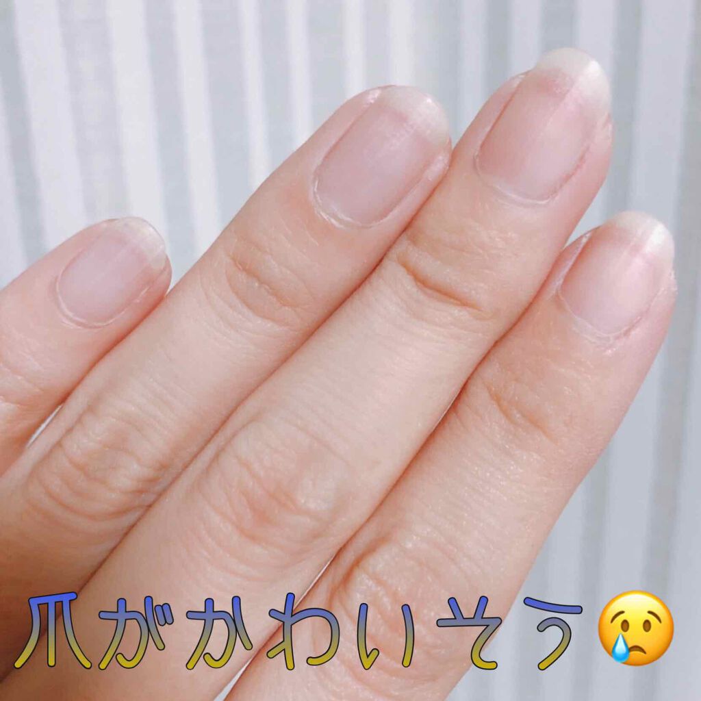 ウォータリーネイルジェル クイックグロス		/D-UP/オールインワンネイルを使ったクチコミ（2枚目）