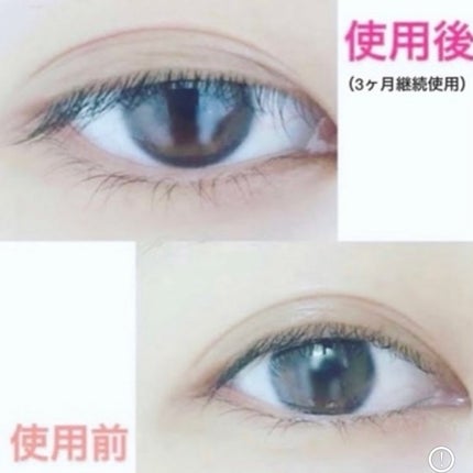 アイラッシュセラム/VIYEUX/まつげ美容液を使ったクチコミ(4枚目)