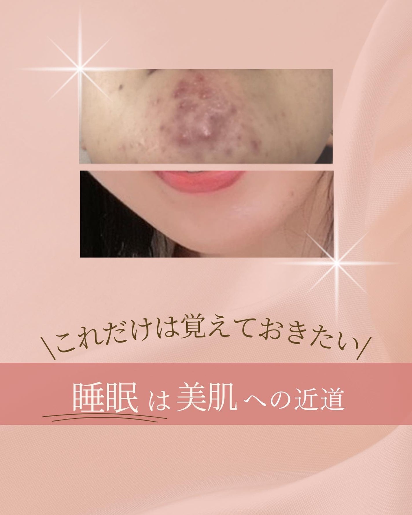 ã¿ãð¹ on LIPS ãããã ãã¯èŠããŠãããã/ç¡ç ã¯çŸèãžã®è¿éðŽçŸããèãã€ãã..ãïŒ1æç®ïŒ