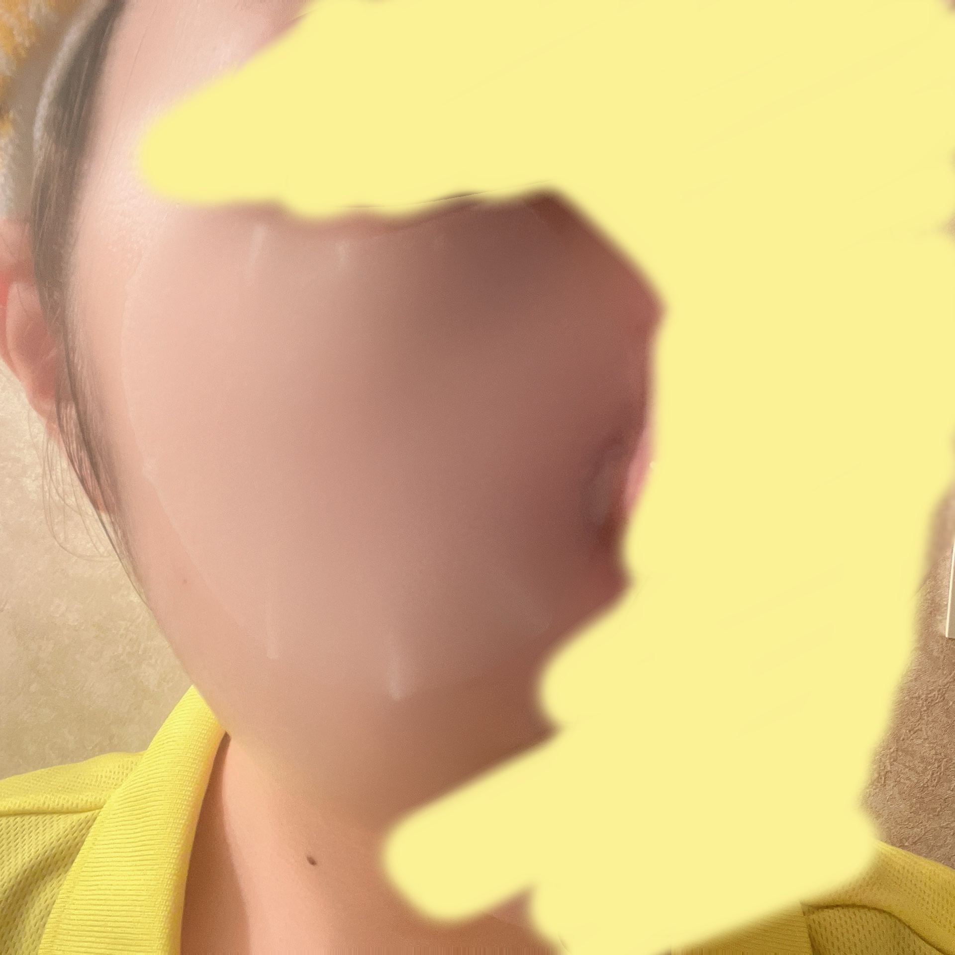 センテラ クイックカーミングパッド/SKIN1004/トナーパッドを使ったクチコミ（3枚目）