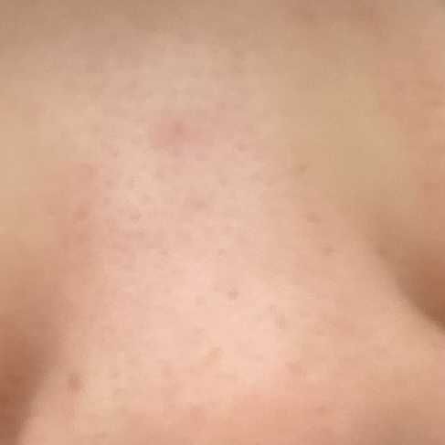 メイク落とし パーフェクトオイル/ビオレ/オイルクレンジングを使ったクチコミ（3枚目）