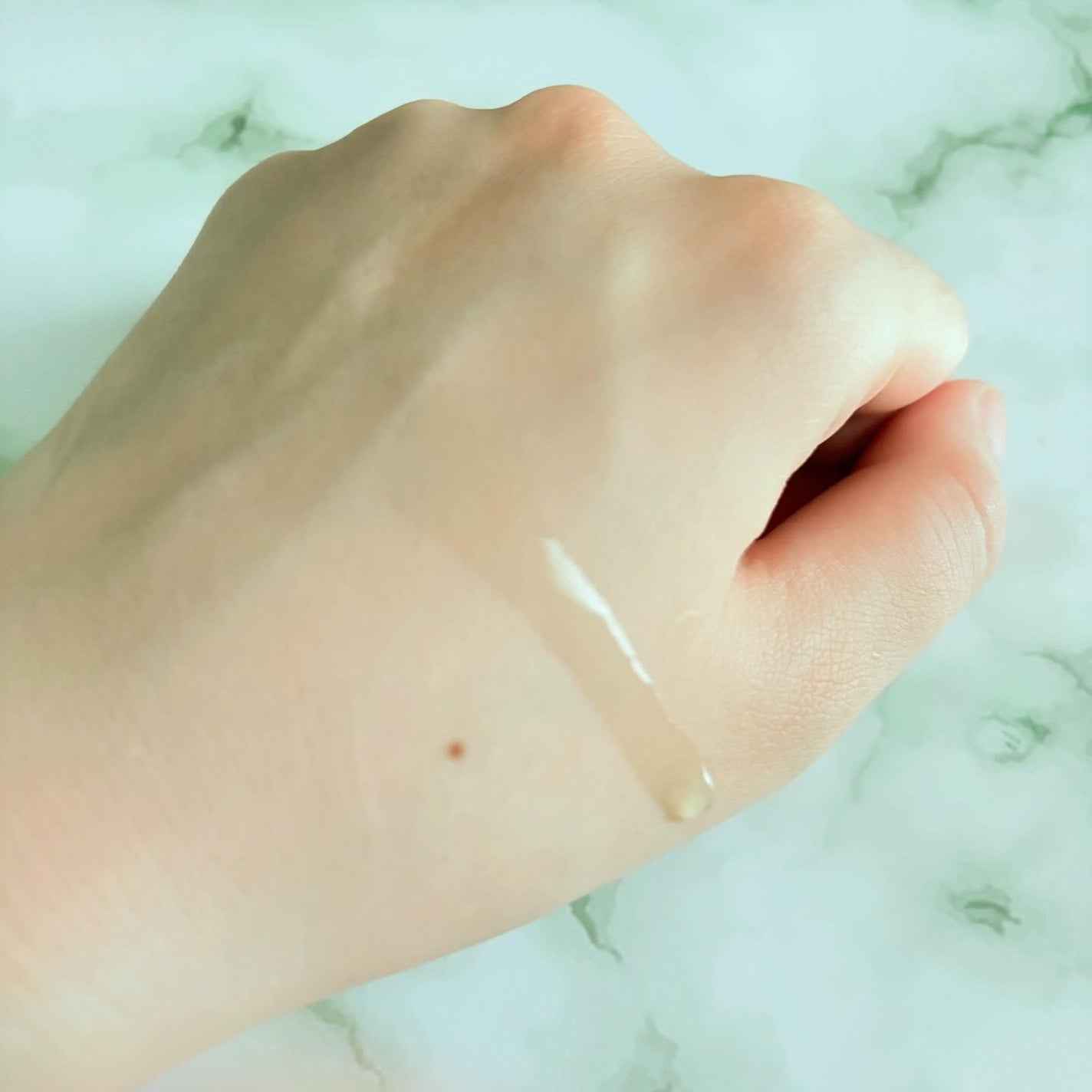 アゼライン酸15 インテンスカーミングセラム/Anua/美容液を使ったクチコミ(3枚目)