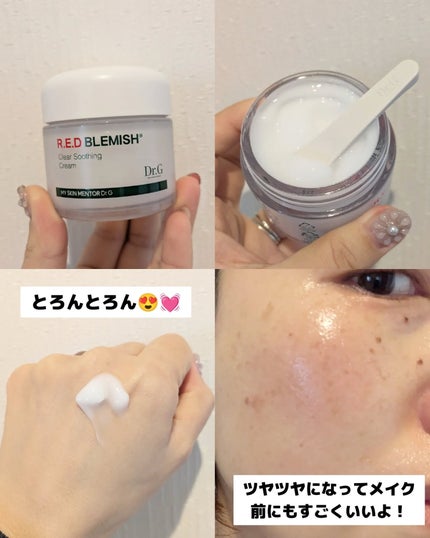 レッドブレミッシュ クリアスージングクリーム/Dr.G/フェイスクリームを使ったクチコミ(3枚目)