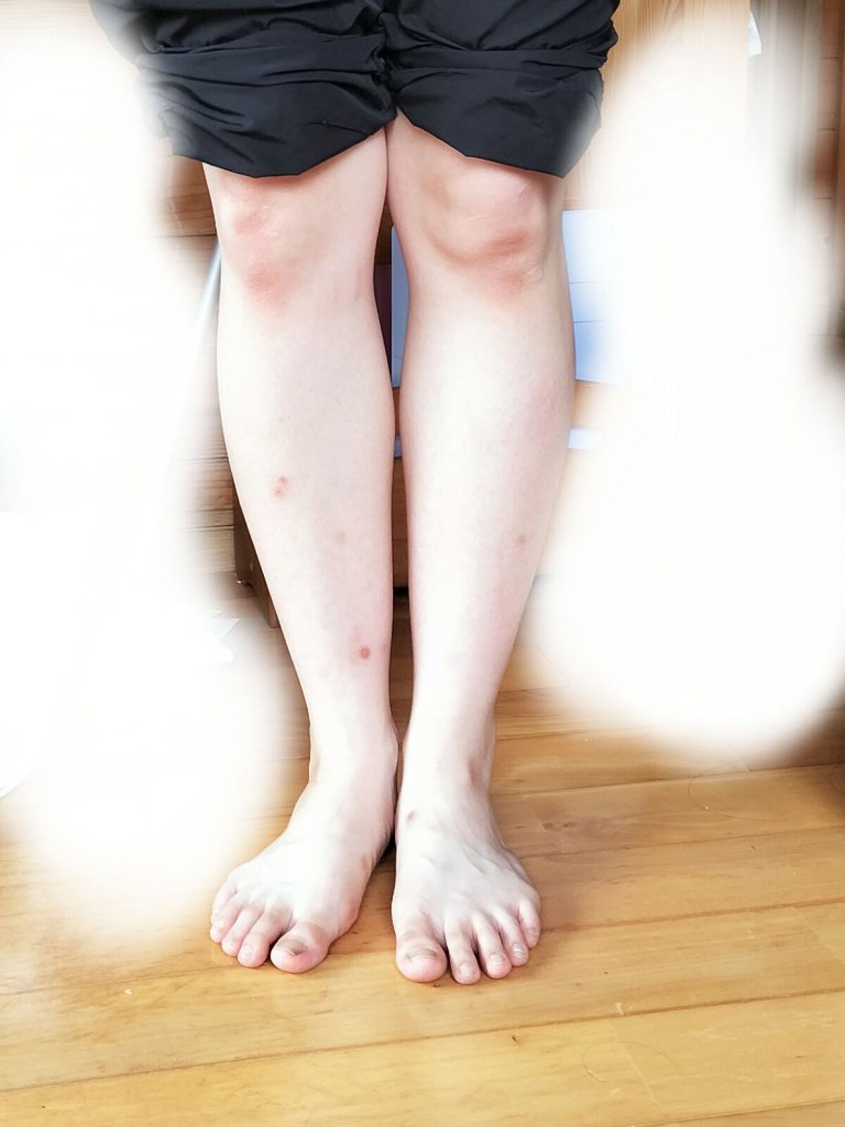 脚やせダンス今日も頑張った‼️


最近、バイトで自転車で20分くらいかけて通勤し始めたので、脚に筋肉付いてふとくなってしまったかも…😭

筋肉を潰すマッサージ始めます❤️‍🔥