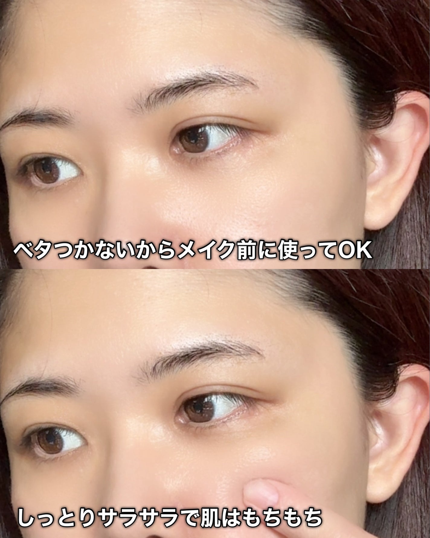 バクチオールポアジェットセラム/Dr.G/美容液を使ったクチコミ(8枚目)